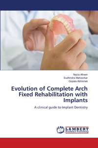 Evolution of Complete Arch Fixed Rehabilitation with Implants