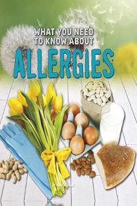 What You Need to Know About Allergies