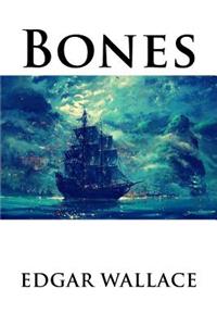 Bones