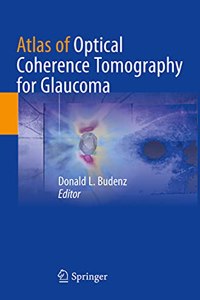 Atlas of Optical Coherence Tomography for Glaucoma