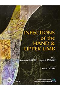 Infections Of The Hand And Upper Limb....