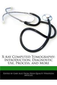 X-Ray Computed Tomography