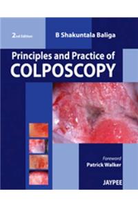 Principles and Practice of Colposcopy