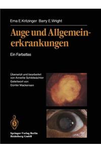 Auge Und Allgemeinerkrankungen