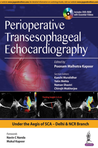 Perioperative Transeasophageal Echocardiography