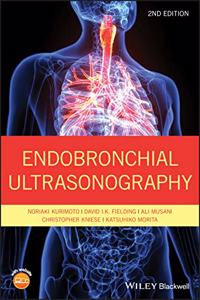 Endobronchial Ultrasonography