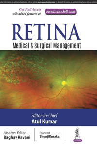 Retina