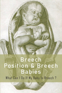 Breech Position & Breech Babies