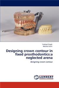 Designing crown contour in fixed prosthodontics