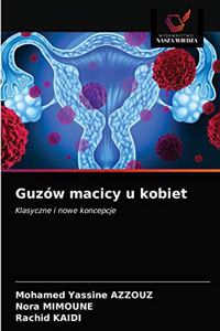 Guzów macicy u kobiet