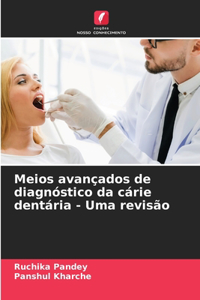 Meios avançados de diagnóstico da cárie dentária - Uma revisão