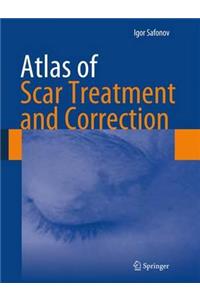 Atlas of Scar Treatment and Correction