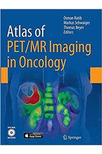 Atlas of Pet/MR Imaging in Oncology
