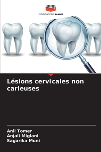 Lésions cervicales non carieuses