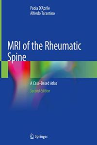 MRI of the Rheumatic Spine