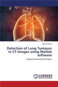 Detection of Lung Tumours in CT Images using Matlab software