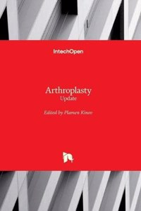 Arthroplasty