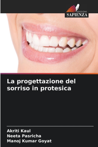 progettazione del sorriso in protesica