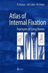 Atlas of Internal Fixation