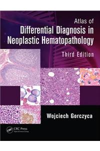 Atlas of Differential Diagnosis in Neoplastic Hematopathology, Third Edition