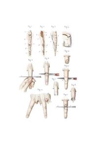 Disarticulation of Phalanges and Finger Composition Notebook