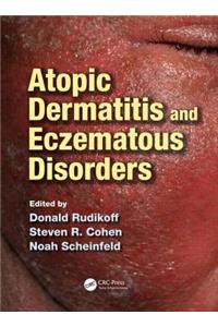 Atopic Dermatitis and Eczematous Disorders