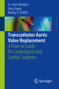 Transcatheter Aortic Valve Replacement