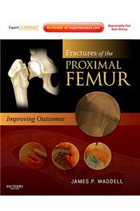 Fractures of the Proximal Femur: Improving Outcomes: Expert Consult: Online and Print: Improving Outcomes
