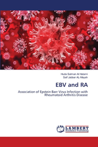 EBV and RA