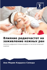 Влияние радиочастот на заживление кожных