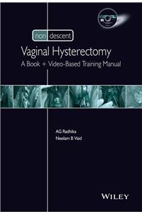 Non-Descent Vaginal Hysterectomy: A Book + Video-Based Training Manual