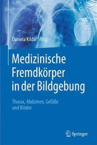 Medizinische Fremdkörper in Der Bildgebung