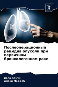 Послеоперационный рецидив опухоли при пе