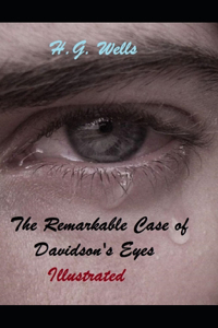 The Remarkable Case of Davidson's Eyes Illustrated