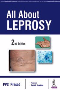 All About Leprosy
