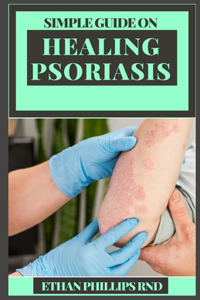 Simple Guide on Healing Psoriasis