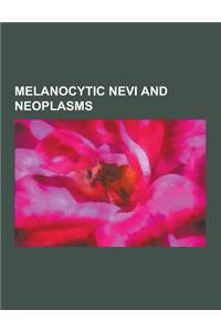 Melanocytic Nevi and Neoplasms