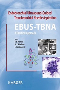 Endobronchial Ultrasound-Guided Transbronchial Needle Aspira