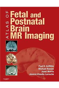 Atlas of Fetal and Postnatal Brain MR