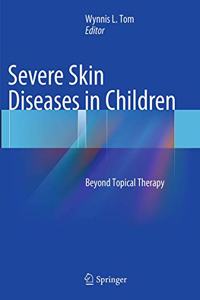 Severe Skin Diseases in Children: Beyond Topical Therapy