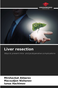 Liver resection