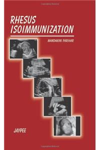 Rhesus Isoimmunization (FOGSI)
