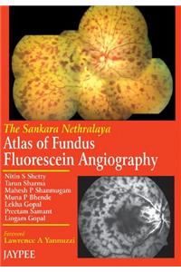 Atlas of Fundus Fluorescein Angiography