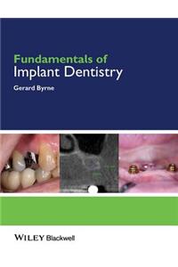 Fundamentals of Implant Dentistry