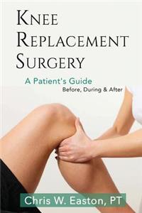 Knee Replacement Surgery, A Patient's Guide: Before, During & After