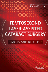 Femtosecond Laser-Assisted Cataract Surgery