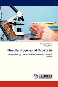 Needle Biopsies of Prostate