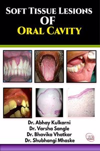 SOFT TISSUE LESIONS OF ORAL CAVITY
