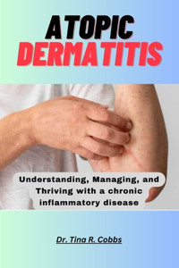 Atopic Dermatitis