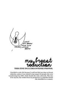 Why I Got My Breast Reduction